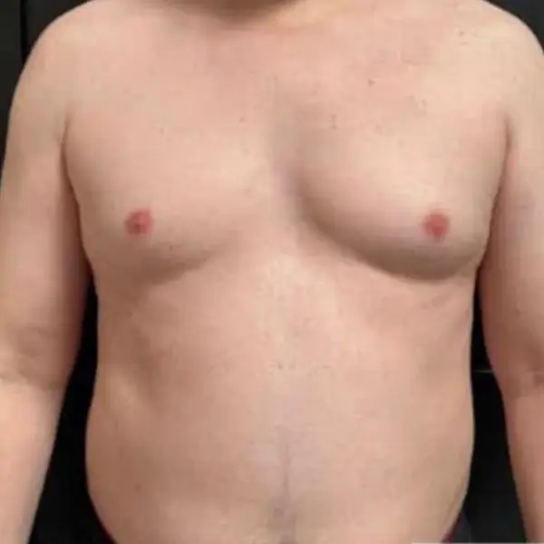 Transformation physique, après le programme