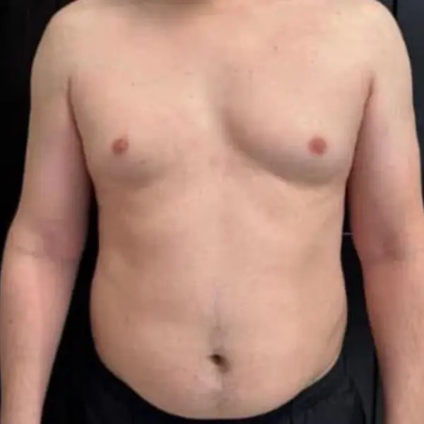 Transformation physique, avant le programme